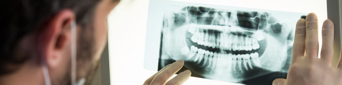 Digital X-rays Port Hope Dental